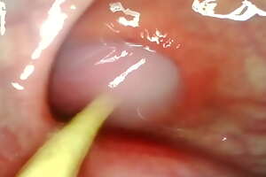 ANAL POV. CAMERA INSIDE HER ASSHOLE Painless I POUND HER With respect to MY Chubby Load of shit AND CUM DEEP INSIDE